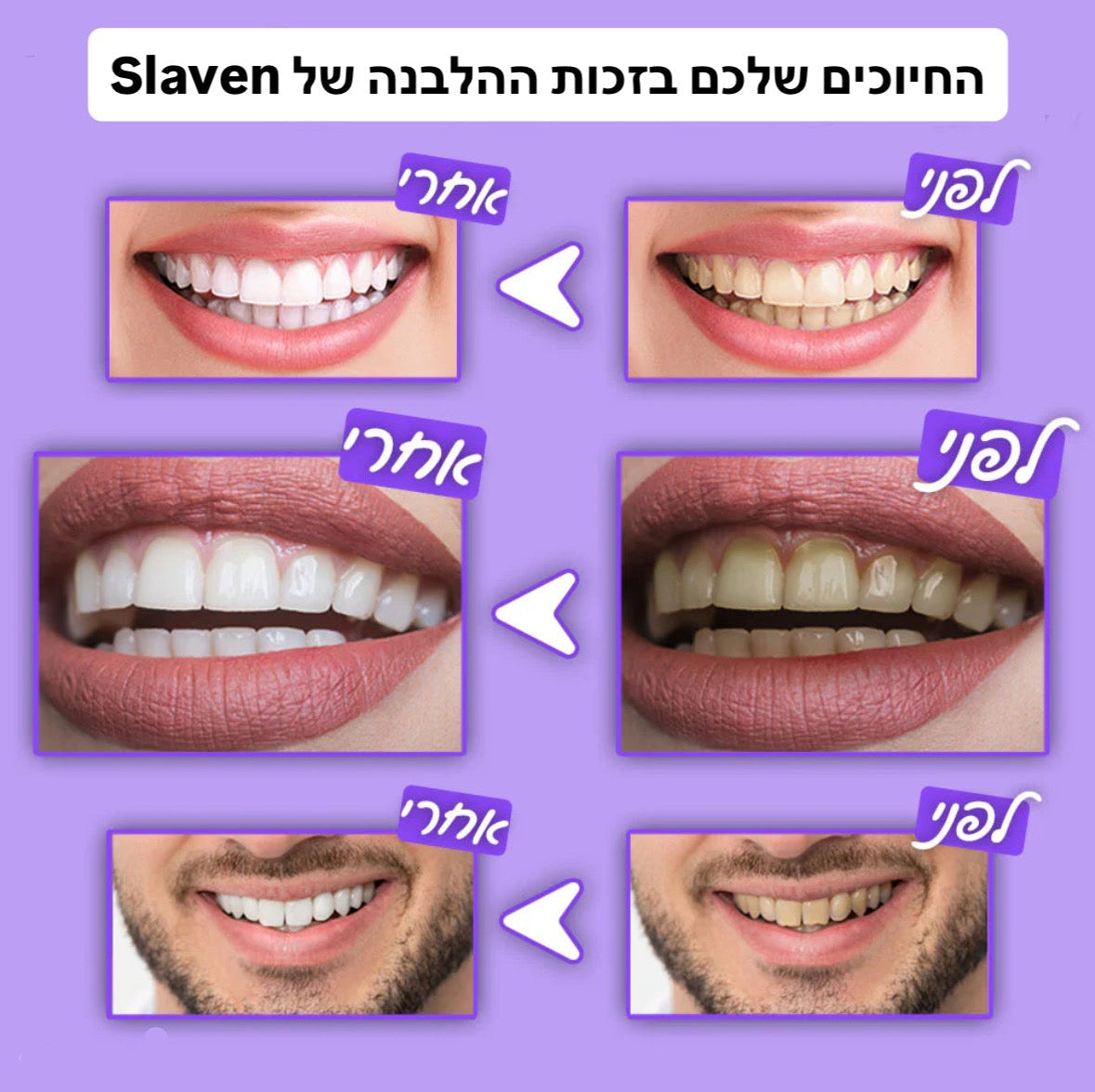 מארז הלבנת שיניים